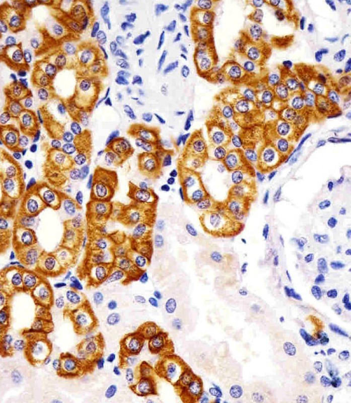 Paraformaldehyde-fixed, paraffin embedded Human kidney tissue; Antigen retrieval by boiling in sodium citrate buffer (pH6.0) for 15min; Block endogenous peroxidase by 3% hydrogen peroxide for 15 minutes; Blocking buffer (3% BSA) at room temperature for 30min; Antibody incubation with KRT19 (979CT14.3.1) Monoclonal Antibody (bsm-51308M) at 1:25 for 1 hour at 37°C, followed by a conjugated secondary antibody for 20 minutes and DAB staining.