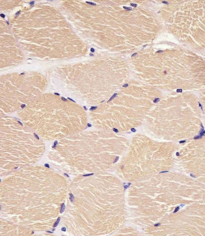 Paraformaldehyde-fixed, paraffin embedded human skeletal muscle tissue; Antigen retrieval by boiling in sodium citrate buffer (pH6.0) for 15min; Block endogenous peroxidase by 3% hydrogen peroxide for 15 minutes; Blocking buffer (3% BSA) at room temperature for 30min; Antibody incubation with DENR (2C9) Monoclonal Antibody (bsm-51318M) at 1:25 for 1 hour at 37°C, followed by a conjugated secondary antibody for 20 minutes and DAB staining.