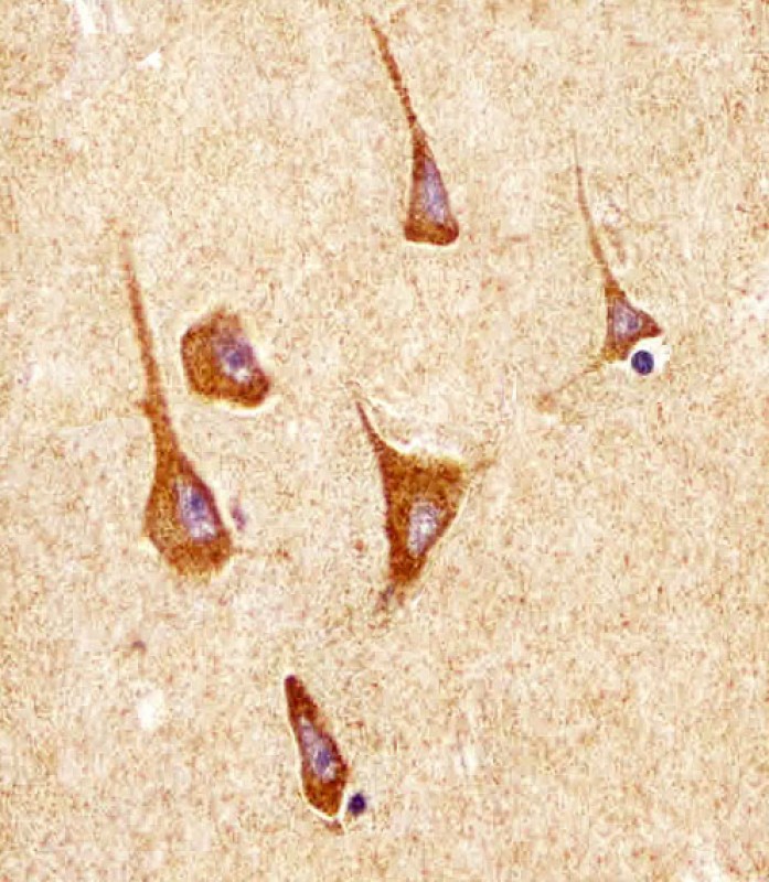 Paraformaldehyde-fixed, paraffin embedded human brain tissue; Antigen retrieval by boiling in sodium citrate buffer (pH6.0) for 15min; Block endogenous peroxidase by 3% hydrogen peroxide for 15 minutes; Blocking buffer (3% BSA) at room temperature for 30min; Antibody incubation with SODM (9C3) Monoclonal Antibody (bsm-51319M) at 1:25 for 1 hour at 37°C, followed by a conjugated secondary antibody for 20 minutes and DAB staining.