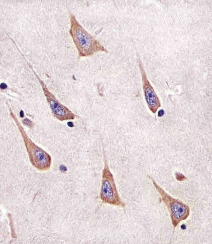 Paraformaldehyde-fixed, paraffin embedded human brain tissue; Antigen retrieval by boiling in sodium citrate buffer (pH6.0) for 15min; Block endogenous peroxidase by 3% hydrogen peroxide for 15 minutes; Blocking buffer (3% BSA) at room temperature for 30min; Antibody incubation with RAB11A (6C8) Monoclonal Antibody (bsm-51322M) at 1:25 for 1 hour at 37°C, followed by a conjugated secondary antibody for 20 minutes and DAB staining.