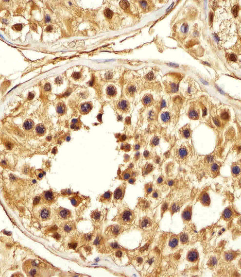 Paraformaldehyde-fixed, paraffin embedded human testis tissue; Antigen retrieval by boiling in sodium citrate buffer (pH6.0) for 15min; Block endogenous peroxidase by 3% hydrogen peroxide for 15 minutes; Blocking buffer (3% BSA) at room temperature for 30min; Antibody incubation with PSMA5 (426CT8.5.1) Monoclonal Antibody (bsm-51389M) at 1:25 for 1 hour at 37°C, followed by a conjugated secondary antibody for 20 minutes and DAB staining.