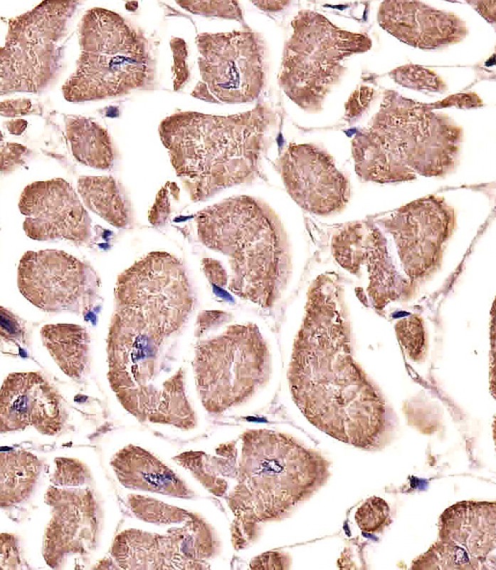 Paraformaldehyde-fixed, paraffin embedded human heart tissue; Antigen retrieval by boiling in sodium citrate buffer (pH6.0) for 15min; Block endogenous peroxidase by 3% hydrogen peroxide for 15 minutes; Blocking buffer (3% BSA) at room temperature for 30min; Antibody incubation with MYO18B (3C5) Monoclonal Antibody (bsm-51376M) at 1:25 for 1 hour at 37°C, followed by a conjugated secondary antibody for 20 minutes and DAB staining.