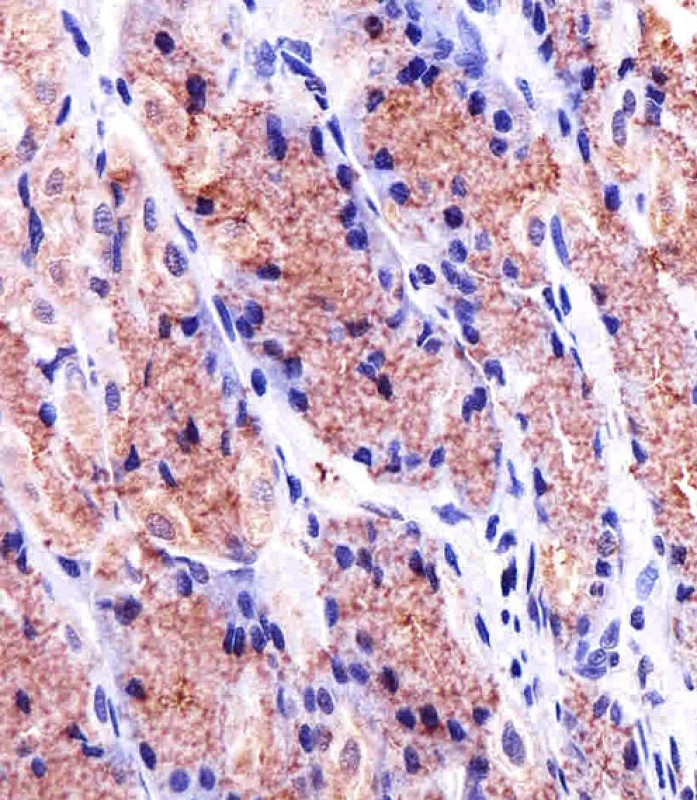 Paraformaldehyde-fixed, paraffin embedded human stomach tissue; Antigen retrieval by boiling in sodium citrate buffer (pH6.0) for 15min; Block endogenous peroxidase by 3% hydrogen peroxide for 15 minutes; Blocking buffer (3% BSA) at room temperature for 30min; Antibody incubation with PHB (12C6) Monoclonal Antibody (bsm-51395M) at 1:25 for 1 hour at 37°C, followed by a conjugated secondary antibody for 20 minutes and DAB staining.