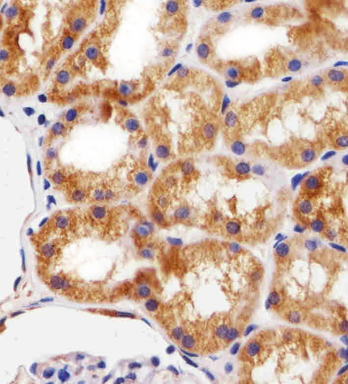 Paraformaldehyde-fixed, paraffin embedded Human Kidney tissue; Antigen retrieval by boiling in sodium citrate buffer (pH6.0) for 15min; Block endogenous peroxidase by 3% hydrogen peroxide for 15 minutes; Blocking buffer (3% BSA) at room temperature for 30min; Antibody incubation with BCL10 (5C2) Monoclonal Antibody (bsm-51398M) at 1:25 for 1 hour at 37°C, followed by a conjugated secondary antibody for 20 minutes and DAB staining.