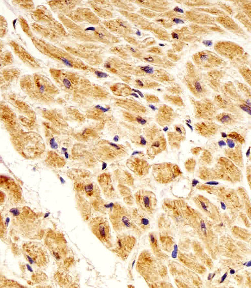Paraformaldehyde-fixed, paraffin embedded Human heart tissue; Antigen retrieval by boiling in sodium citrate buffer (pH6.0) for 15min; Block endogenous peroxidase by 3% hydrogen peroxide for 15 minutes; Blocking buffer (3% BSA) at room temperature for 30min; Antibody incubation with NME1 (1172CT2.4.1.1) Monoclonal Antibody (bsm-51413M) at 1:25 for 1 hour at 37°C, followed by a conjugated secondary antibody for 20 minutes and DAB staining.