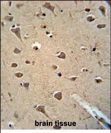 Paraformaldehyde-fixed, paraffin embedded Human brain tissue; Antigen retrieval by boiling in sodium citrate buffer (pH6.0) for 15min; Block endogenous peroxidase by 3% hydrogen peroxide for 15 minutes; Blocking buffer (3% BSA) at room temperature for 30min; Antibody incubation with ANTIBODY Monoclonal Antibody (bsm-51417M) at 1:50 for 1 hour at 37°C, followed by a conjugated secondary antibody for 20 minutes and DAB staining.