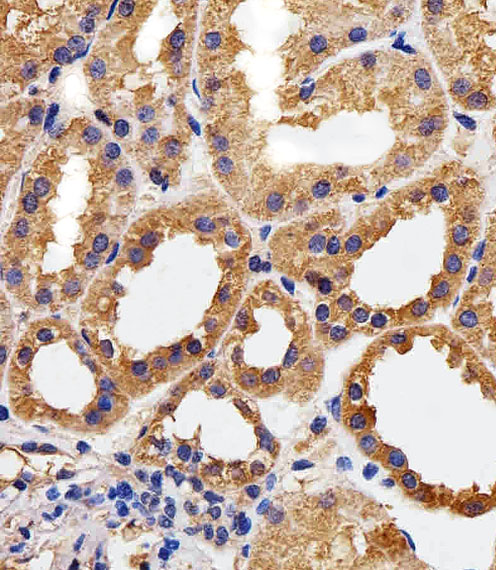 Paraformaldehyde-fixed, paraffin embedded human kidney tissue; Antigen retrieval by boiling in sodium citrate buffer (pH6.0) for 15min; Block endogenous peroxidase by 3% hydrogen peroxide for 15 minutes; Blocking buffer (3% BSA) at room temperature for 30min; Antibody incubation with CAPN1 (6C5) Monoclonal Antibody (bsm-51419M) at 1:25 for 1 hour at 37°C, followed by a conjugated secondary antibody for 20 minutes and DAB staining.