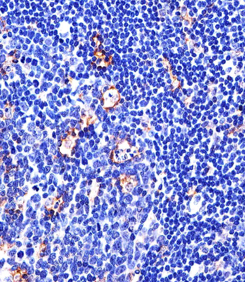 Paraformaldehyde-fixed, paraffin embedded human tonsil tissue; Antigen retrieval by boiling in sodium citrate buffer (pH6.0) for 15min; Block endogenous peroxidase by 3% hydrogen peroxide for 15 minutes; Blocking buffer (3% BSA) at room temperature for 30min; Antibody incubation with ITGB2 (534CT6.2.1) Monoclonal Antibody (bsm-51424M) at 1:25 for 1 hour at 37°C, followed by a conjugated secondary antibody for 20 minutes and DAB staining.