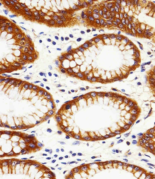 Paraformaldehyde-fixed, paraffin embedded human stomach tissue; Antigen retrieval by boiling in sodium citrate buffer (pH6.0) for 15min; Block endogenous peroxidase by 3% hydrogen peroxide for 15 minutes; Blocking buffer (3% BSA) at room temperature for 30min; Antibody incubation with CAPN2 (1C1) Monoclonal Antibody (bsm-51429M) at 1:25 for 1 hour at 37°C, followed by a conjugated secondary antibody for 20 minutes and DAB staining.