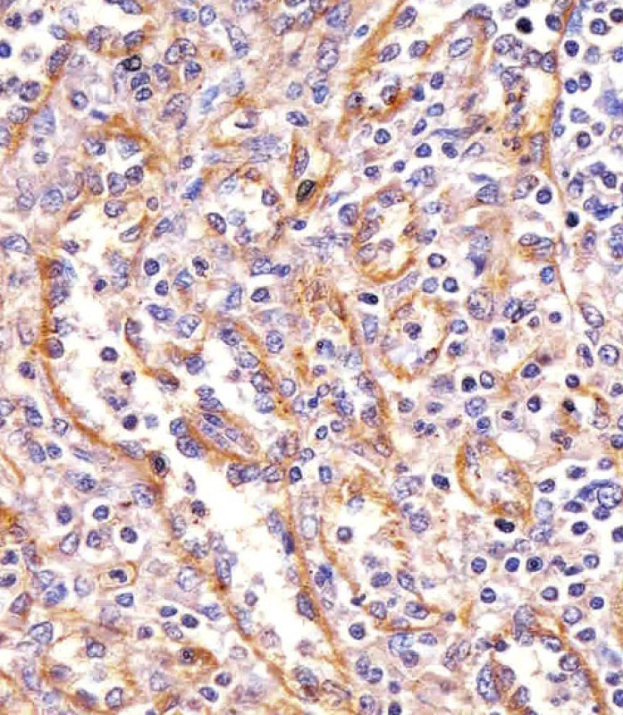 Paraformaldehyde-fixed, paraffin embedded human spleen tissue; Antigen retrieval by boiling in sodium citrate buffer (pH6.0) for 15min; Block endogenous peroxidase by 3% hydrogen peroxide for 15 minutes; Blocking buffer (3% BSA) at room temperature for 30min; Antibody incubation with PPP2R1B (6C6) Monoclonal Antibody (bsm-51443M) at 1:25 for 1 hour at 37°C, followed by a conjugated secondary antibody for 20 minutes and DAB staining.