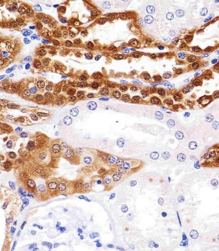 Paraformaldehyde-fixed, paraffin embedded human kidney tissue; Antigen retrieval by boiling in sodium citrate buffer (pH6.0) for 15min; Block endogenous peroxidase by 3% hydrogen peroxide for 15 minutes; Blocking buffer (3% BSA) at room temperature for 30min; Antibody incubation with UCHL1 (346CT2.2.1) Monoclonal Antibody (bsm-51100M) at 1:25 for 1 hour at 37°C, followed by a conjugated secondary antibody for 20 minutes and DAB staining.