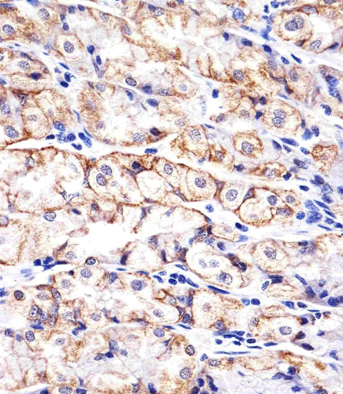 Paraformaldehyde-fixed, paraffin embedded human stomach tissue; Antigen retrieval by boiling in sodium citrate buffer (pH6.0) for 15min; Block endogenous peroxidase by 3% hydrogen peroxide for 15 minutes; Blocking buffer (3% BSA) at room temperature for 30min; Antibody incubation with CDH1 (813CT11.1.3) Monoclonal Antibody (bsm-51214M) at 1:25 for 1 hour at 37°C, followed by a conjugated secondary antibody for 20 minutes and DAB staining.