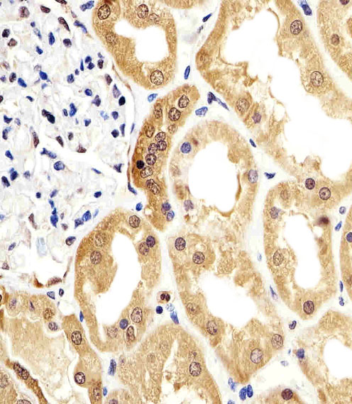Paraformaldehyde-fixed, paraffin embedded human kidney tissue; Antigen retrieval by boiling in sodium citrate buffer (pH6.0) for 15min; Block endogenous peroxidase by 3% hydrogen peroxide for 15 minutes; Blocking buffer (3% BSA) at room temperature for 30min; Antibody incubation with ENO1 (7C4) Monoclonal Antibody (bsm-51216M) at 1:25 for 1 hour at 37°C, followed by a conjugated secondary antibody for 20 minutes and DAB staining.