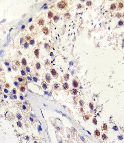 Paraformaldehyde-fixed, paraffin embedded human testis tissue; Antigen retrieval by boiling in sodium citrate buffer (pH6.0) for 15min; Block endogenous peroxidase by 3% hydrogen peroxide for 15 minutes; Blocking buffer (3% BSA) at room temperature for 30min; Antibody incubation with TBP (8C4) Monoclonal Antibody (bsm-51220M) at 1:25 for 1 hour at 37°C, followed by a conjugated secondary antibody for 20 minutes and DAB staining.