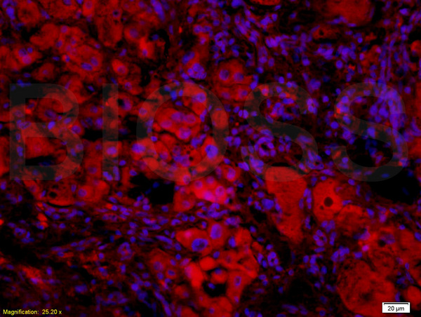 Formalin-fixed and paraffin-embedded: rat liver tissue labeled with Rabbit Anti-BAFF/CD257 Polyclonal Antibody, Unconjugated (bs-2431R) 1:200 followed by conjugation to the secondary Cy3 antibody