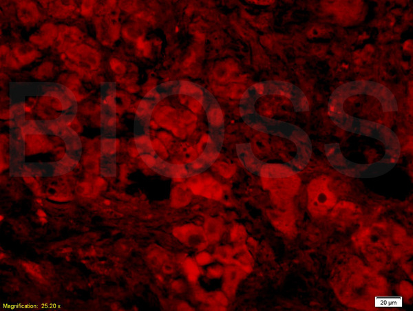 Formalin-fixed and paraffin-embedded: rat liver tissue labeled with Rabbit Anti-BAFF/CD257 Polyclonal Antibody, Unconjugated (bs-2431R) 1:200 followed by conjugation to the secondary Cy3 antibody