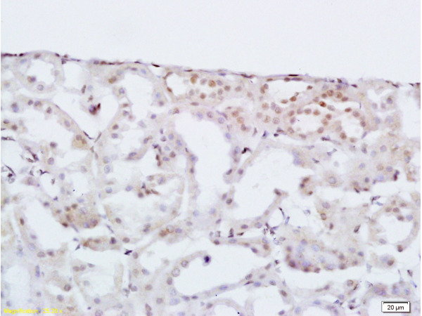 Formalin-fixed and paraffin-embedded: rat kidney tissue labeled with Rabbit Anti-HOXA10 Polyclonal Antibody (bs-2502R), Unconjugated 1:200 followed by conjugation to the secondary antibody and DAB staining