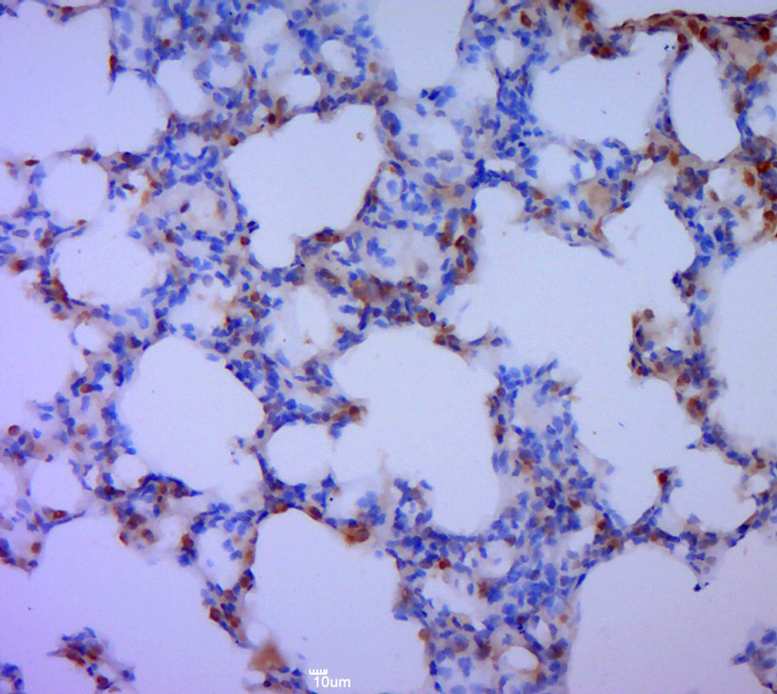 Paraformaldehyde-fixed, paraffin embedded rat lung; Antigen retrieval by boiling in sodium citrate buffer (pH6.0) for 15min; Block endogenous peroxidase by 3% hydrogen peroxide for 20 minutes; Blocking buffer (normal goat serum) at 37°C for 30min; Antibody incubation with (Hi95) Polyclonal Antibody, Unconjugated (bs-8326R) at 1:400 overnight at 4°C, followed by a conjugated secondary for 20 minutes and DAB staining. _x000D_ _x000D_ _x000D_