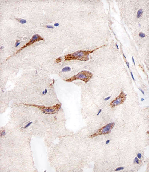 Paraformaldehyde-fixed, paraffin embedded human brain tissue; Antigen retrieval by boiling in sodium citrate buffer (pH6.0) for 15min; Block endogenous peroxidase by 3% hydrogen peroxide for 15 minutes; Blocking buffer (3% BSA) at room temperature for 30min; Antibody incubation with AURKA (4C5) Monoclonal Antibody (bsm-51279M) at 1:25 for 1 hour at 37°C, followed by a conjugated secondary antibody for 20 minutes and DAB staining.
