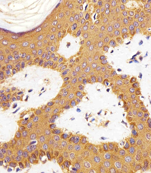 Paraformaldehyde-fixed, paraffin embedded human skin tissue; Antigen retrieval by boiling in sodium citrate buffer (pH6.0) for 15min; Block endogenous peroxidase by 3% hydrogen peroxide for 15 minutes; Blocking buffer (3% BSA) at room temperature for 30min; Antibody incubation with RAC1 (13C4) Monoclonal Antibody (bsm-51282M) at 1:25 for 1 hour at 37°C, followed by a conjugated secondary antibody for 20 minutes and DAB staining.