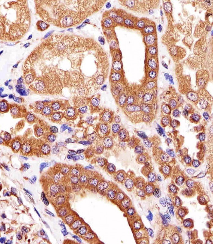 Paraformaldehyde-fixed, paraffin embedded human kidney tissue; Antigen retrieval by boiling in sodium citrate buffer (pH6.0) for 15min; Block endogenous peroxidase by 3% hydrogen peroxide for 15 minutes; Blocking buffer (3% BSA) at room temperature for 30min; Antibody incubation with ATG3 (7C2) Monoclonal Antibody (bsm-51284M) at 1:25 for 1 hour at 37°C, followed by a conjugated secondary antibody for 20 minutes and DAB staining.
