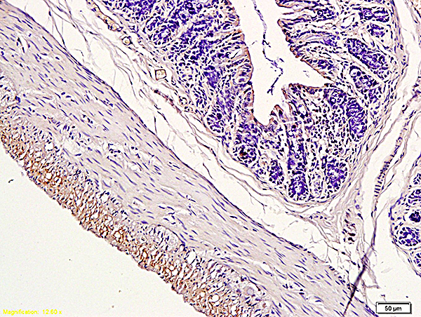 Formalin-fixed and paraffin-embedded rat colon labeled with Rabbit Anti-CD163/M130 Polyclonal Antibody, Unconjugated( bs-2527R) followed by conjugation to the secondary antibody and DAB staining