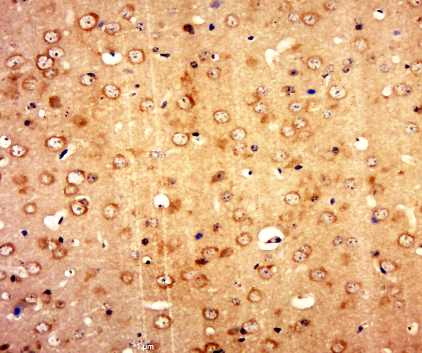 Paraformaldehyde-fixed, paraffin embedded mouse brain tissue; Antigen retrieval by boiling in sodium citrate buffer(pH6) for 15min; Block endogenous peroxidase by 3% hydrogen peroxide for 30 minutes; Blocking buffer (normal goat serum) at 37°C for 20min; Antibody incubation with Rabbit Anti-GARASP2 Polyclonal Antibody, Unconjugated (bs-13492R) at 1:500 overnight at 4°C, followed by a conjugated secondary and DAB staining