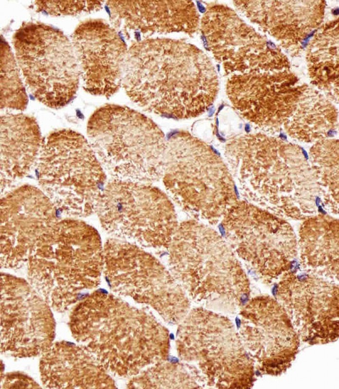 Paraformaldehyde-fixed, paraffin embedded human skeletal muscle tissue; Antigen retrieval by boiling in sodium citrate buffer (pH6.0) for 15min; Block endogenous peroxidase by 3% hydrogen peroxide for 15 minutes; Blocking buffer (3% BSA) at room temperature for 30min; Antibody incubation with RPTOR (14C4) Monoclonal Antibody (bsm-51285M) at 1:25 for 1 hour at 37°C, followed by a conjugated secondary antibody for 20 minutes and DAB staining.