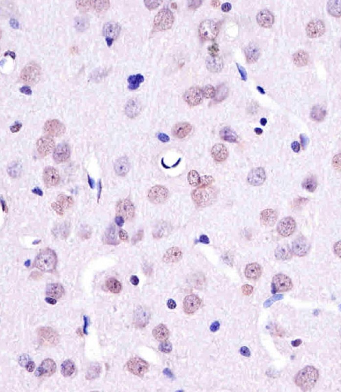 Paraformaldehyde-fixed, paraffin embedded Rat brain tissue; Antigen retrieval by boiling in sodium citrate buffer (pH6.0) for 15min; Block endogenous peroxidase by 3% hydrogen peroxide for 15 minutes; Blocking buffer (3% BSA) at room temperature for 30min; Antibody incubation with YY1 (3C6) Monoclonal Antibody (bsm-51412M) at 1:25 for 1 hour at 37°C, followed by a conjugated secondary antibody for 20 minutes and DAB staining.