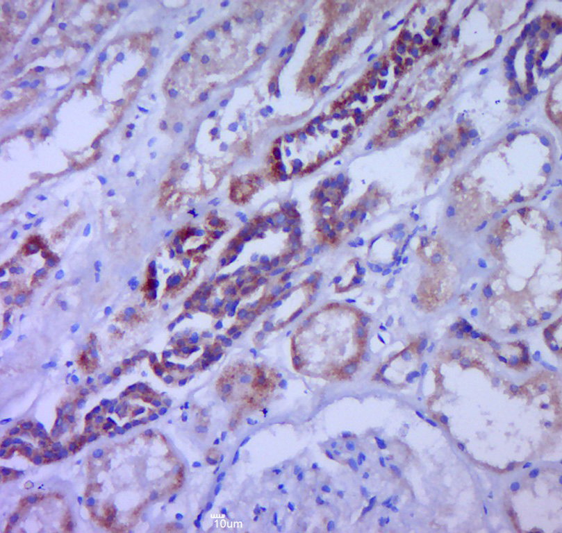 Paraformaldehyde-fixed, paraffin embedded human kidney; Antigen retrieval by boiling in sodium citrate buffer (pH6.0) for 15min; Block endogenous peroxidase by 3% hydrogen peroxide for 20 minutes; Blocking buffer (normal goat serum) at 37°C for 30min; Antibody incubation with CSF3 Polyclonal Antibody, Unconjugated (bs-1023R) at 1:400 overnight at 4°C, followed by a conjugated secondary for 20 minutes and DAB staining.