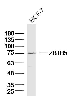 MCF-7 Cell lysates probed with ZBTB5 Polyclonal Antibody, unconjugated (bs-13581R) at 1:300 overnight at 4°C followed by a conjugated secondary antibody for 60 minutes at 37°C.