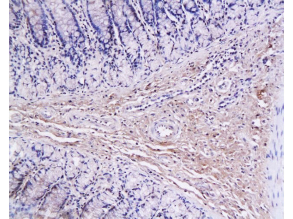 Formalin-fixed and paraffin-embedded rat colon labeled with Anti-Collagen I Polyclonal Antibody, Unconjugated (bs-0578R) 1:200 followed by conjugation to the secondary antibody and DAB staining