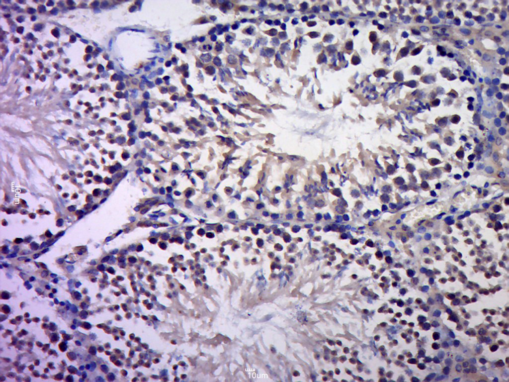 Paraformaldehyde-fixed, paraffin embedded rat testis; Antigen retrieval by boiling in sodium citrate buffer (pH6.0) for 15min; Block endogenous peroxidase by 3% hydrogen peroxide for 20 minutes; Blocking buffer (normal goat serum) at 37°C for 30min; Antibody incubation with c-Jun Polyclonal Antibody, Unconjugated (bs-0670R) at 1:400 overnight at 4°C, followed by a conjugated secondary for 20 minutes and DAB staining.