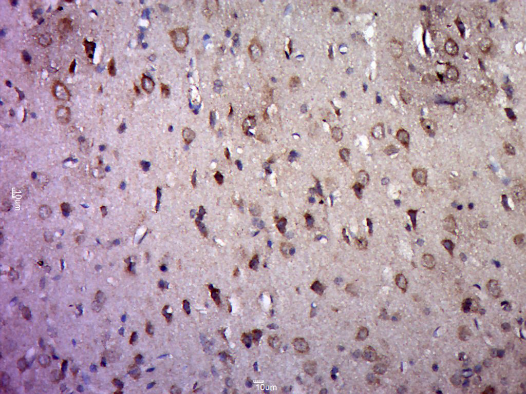 Paraformaldehyde-fixed, paraffin embedded rat brain; Antigen retrieval by boiling in sodium citrate buffer (pH6.0) for 15min; Block endogenous peroxidase by 3% hydrogen peroxide for 20 minutes; Blocking buffer (normal goat serum) at 37°C for 30min; Antibody incubation with 5-HT2A Polyclonal Antibody, Unconjugated (bs-1056R) at 1:400 overnight at 4°C, followed by a conjugated secondary for 20 minutes and DAB staining.