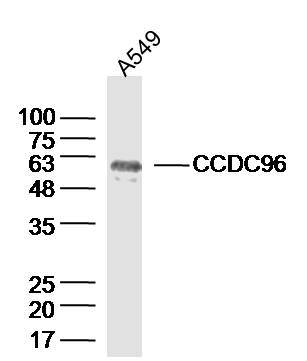 Lane 1: A549 lysates probed with CCDC96 Polyclonal Antibody, Unconjugated (bs-8144R) at 1:300 overnight at 4˚C. Followed by a conjugated secondary antibody at 1:20000 for 60 min at 37˚C.