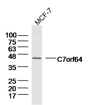 Lane 1: MCF-7 lysates probed with C7orf64 Polyclonal Antibody, Unconjugated (bs-15279R) at 1:300 overnight at 4˚C. Followed by a conjugated secondary antibody at 1:20000 for 60 min at 37˚C.