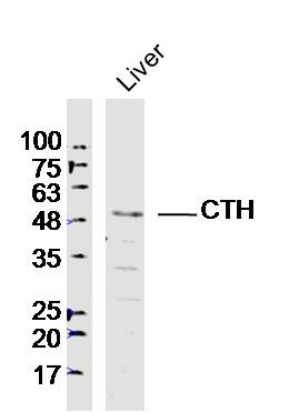 Lane 1: Mouse liver lysates probed with CTH Polyclonal Antibody, Unconjugated (bs-9515R) at 1:300 overnight at 4˚C. Followed by a conjugated secondary antibody at 1:20000 for 60 min at 37˚C.