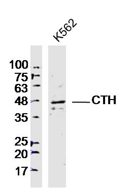 Lane 1: K562 lysates probed with CTH Polyclonal Antibody, Unconjugated (bs-9515R) at 1:300 overnight at 4˚C. Followed by a conjugated secondary antibody at 1:20000 for 60 min at 37˚C.