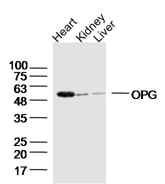 Lane 1:  Mouse heart lysates; Lane 2: Mouse kidney lysates; Lane 3: Mouse liver lysates probed with OPG Polyclonal Antibody (bs-0431R) at 1:300 overnight at 4˚C. Followed by a conjugated secondary antibody at 1:20000 for 90 min at 37˚C.