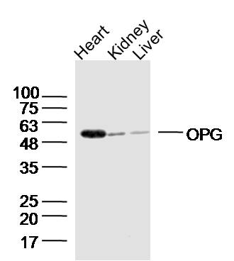 Lane 1: Mouse heart lysates; Lane 2: Mouse kidney lysates; Lane 3: Mouse liver lysates probed with OPG Polyclonal Antibody (bs-0431R) at 1:300 overnight at 4˚C. Followed by a conjugated secondary antibody at 1:20000 for 90 min at 37˚C.