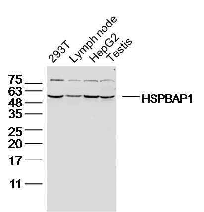 Lane 1: 293T lysates; Lane 2: Mouse lymph node lysates; Lane 3: HepG2 lysates; Lane 4: Mouse testis lysates probed with HSPBAP1 Polyclonal Antibody, Unconjugated (bs-6986R) at 1:300 overnight at 4˚C. Followed by a conjugated secondary antibody at 1:20000 for 60 min at 37˚C.