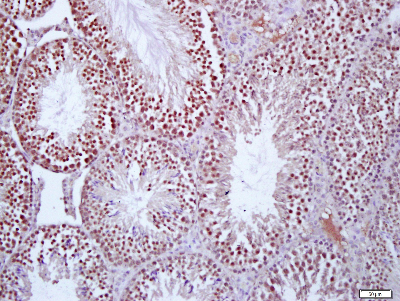 Paraformaldehyde-fixed, paraffin embedded Mouse testis; Antigen retrieval by boiling in sodium citrate buffer (pH6.0) for 15min; Block endogenous peroxidase by 3% hydrogen peroxide for 20 minutes; Blocking buffer (normal goat serum) at 37°C for 30min; Antibody incubation with Protein S Polyclonal Antibody, Unconjugated (bs-9512R) at 1:400 overnight at 4°C, followed by a conjugated secondary antibody for 20 minutes and DAB staining.