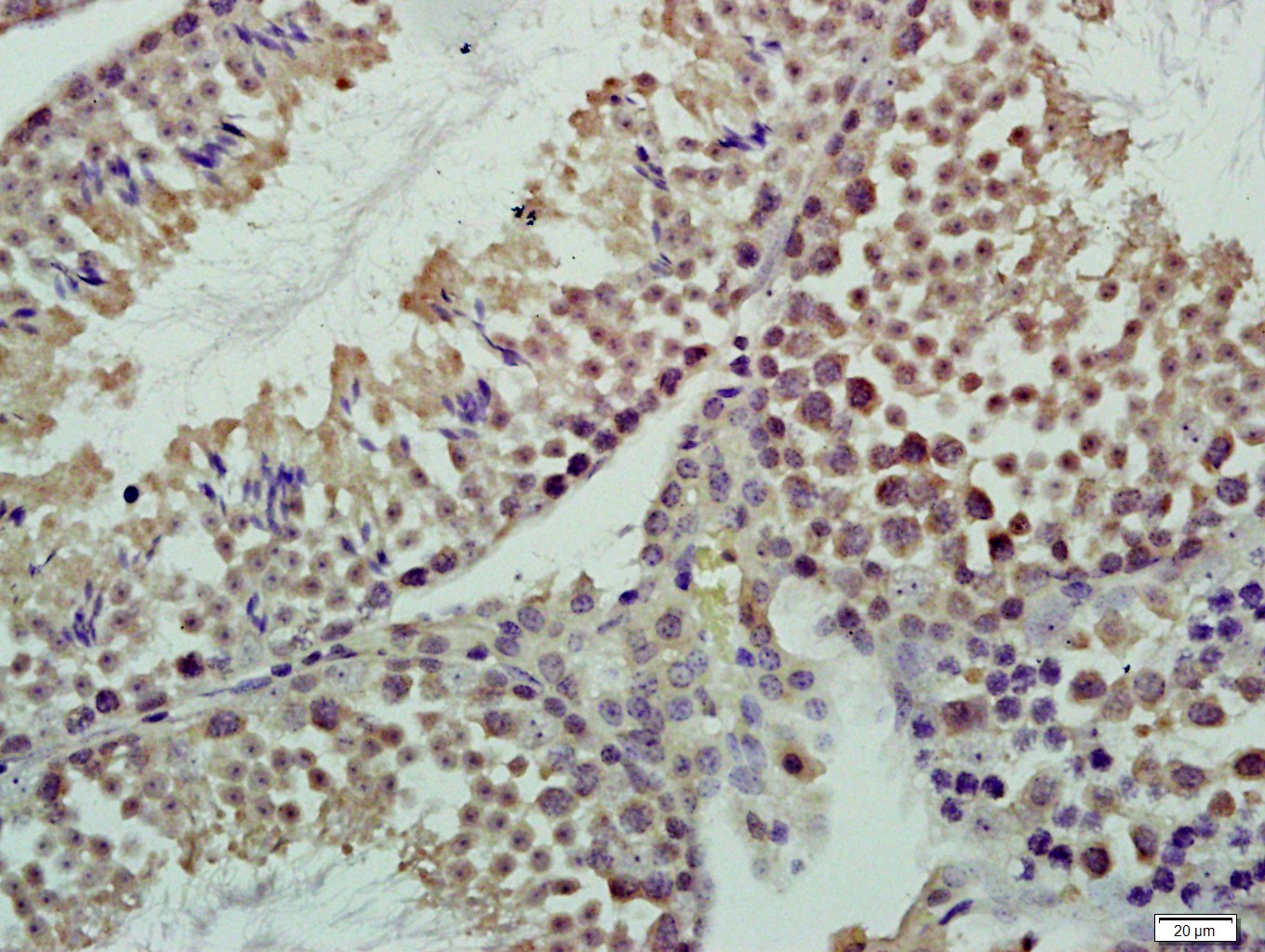Paraformaldehyde-fixed, paraffin embedded Mouse testis; Antigen retrieval by boiling in sodium citrate buffer (pH6.0) for 15min; Block endogenous peroxidase by 3% hydrogen peroxide for 20 minutes; Blocking buffer (normal goat serum) at 37°C for 30min; Antibody incubation with CASC5 Polyclonal Antibody, Unconjugated (bs-5959R) at 1:400 overnight at 4°C, followed by a conjugated secondary antibody for 20 minutes and DAB staining.