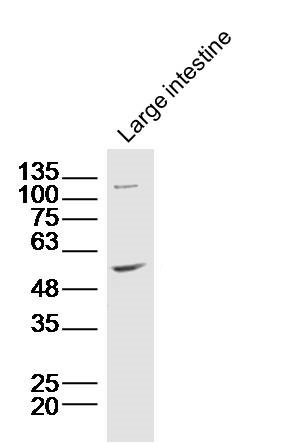 Lane 1: Mouse intestine lysates probed with ZnT-1 Polyclonal Antibody, Unconjugated (bs-6440R) at 1:300 overnight at 4˚C. Followed by a conjugated secondary antibody at 1:20000 for 60 min at 37˚C.
