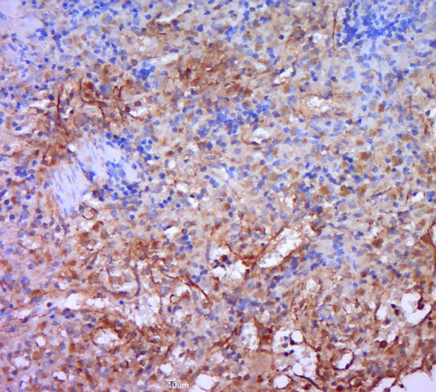 Paraformaldehyde-fixed, paraffin embedded rat spleen tissue; Antigen retrieval by boiling in sodium citrate buffer (pH6.0) for 15min; Block endogenous peroxidase by 3% hydrogen peroxide for 20 minutes; Blocking buffer (normal goat serum) at 37°C for 30min; Antibody incubation with HCST Polyclonal Antibody, Unconjugated (bs-15430R) at 1:400 overnight at 4°C, followed by a conjugated secondary for 20 minutes and DAB staining.