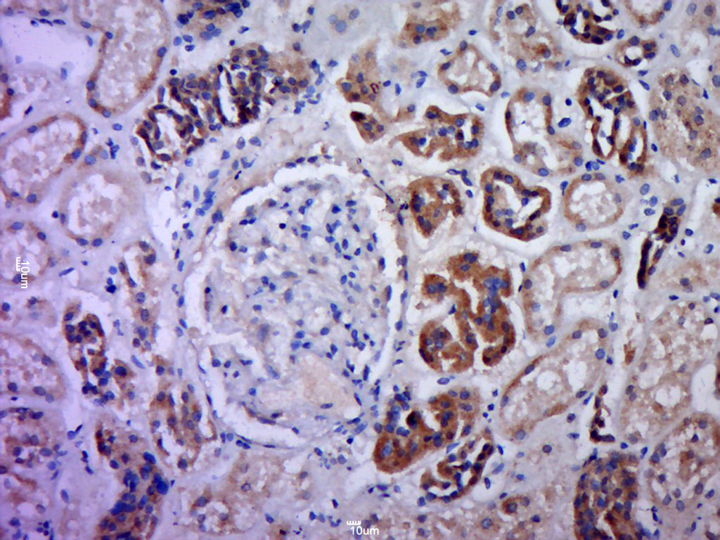 Paraformaldehyde-fixed, paraffin embedded human kidney tissue; Antigen retrieval by boiling in sodium citrate buffer (pH6.0) for 15min; Block endogenous peroxidase by 3% hydrogen peroxide for 20 minutes; Blocking buffer (normal goat serum) at 37°C for 30min; Antibody incubation with C21orf70 Polyclonal Antibody, Unconjugated (bs-9979R) at 1:400 overnight at 4°C, followed by a conjugated secondary for 20 minutes and DAB staining.