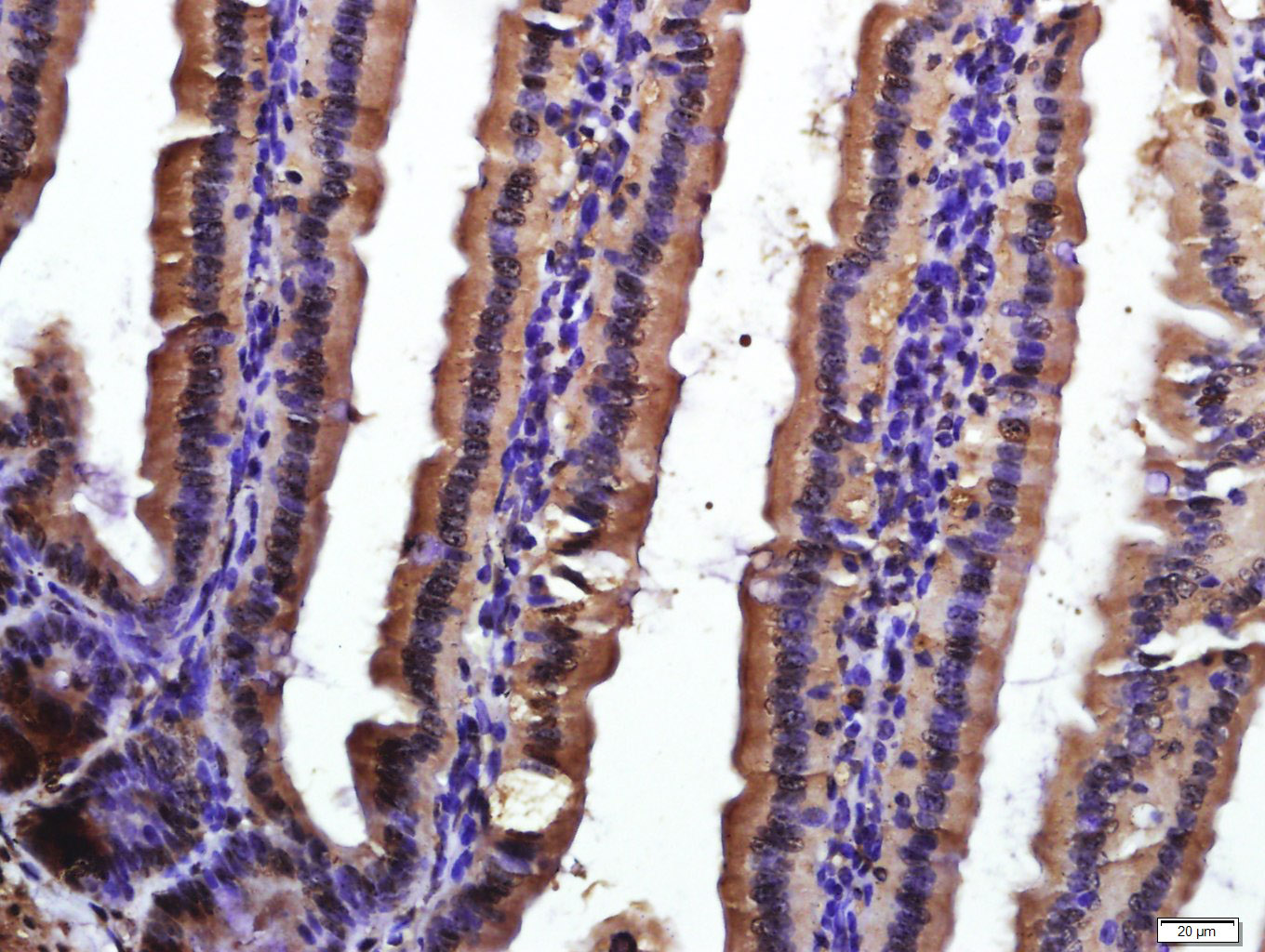 Paraformaldehyde-fixed, paraffin embedded mouse intestine; Antigen retrieval by boiling in sodium citrate buffer (pH6.0) for 15min; Block endogenous peroxidase by 3% hydrogen peroxide for 20 minutes; Blocking buffer (normal goat serum) at 37°C for 30min; Antibody incubation with CD9 Polyclonal Antibody, Unconjugated (bs-2489R) at 1:400 overnight at 4°C, followed by a conjugated secondary for 20 minutes and DAB staining.
