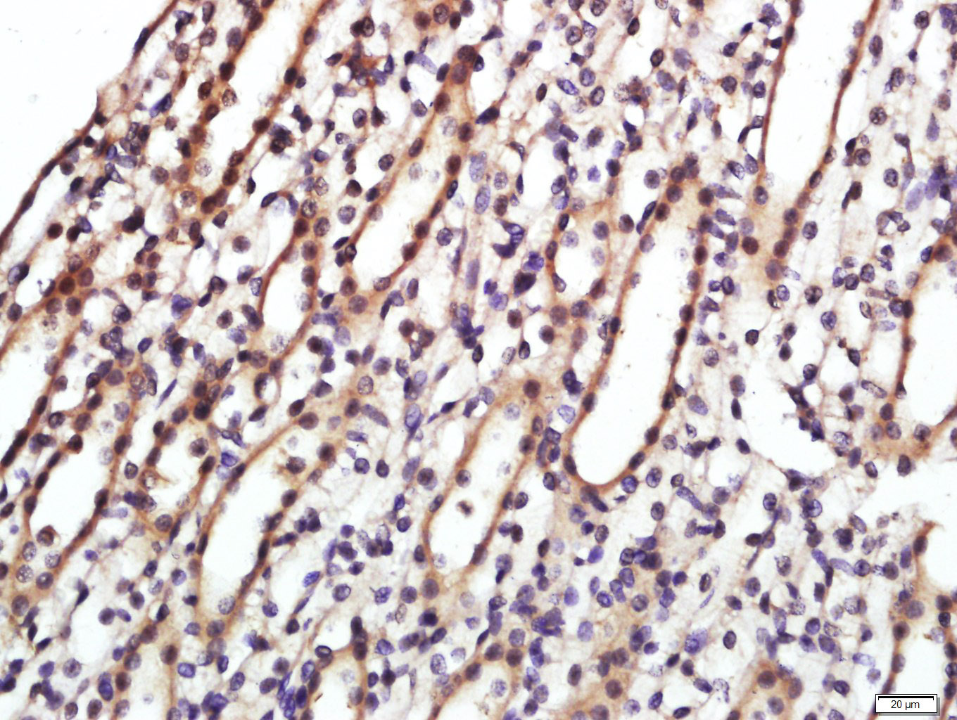 Paraformaldehyde-fixed, paraffin embedded rat kidney; Antigen retrieval by boiling in sodium citrate buffer (pH6.0) for 15min; Block endogenous peroxidase by 3% hydrogen peroxide for 20 minutes; Blocking buffer (normal goat serum) at 37°C for 30min; Antibody incubation with CD9 Polyclonal Antibody, Unconjugated (bs-2489R) at 1:400 overnight at 4°C, followed by a conjugated secondary for 20 minutes and DAB staining.