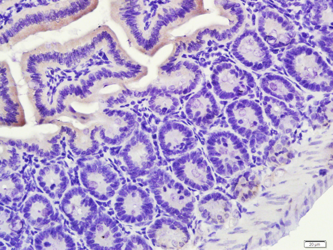 Paraformaldehyde-fixed, paraffin embedded Mouse small intestine; Antigen retrieval by boiling in sodium citrate buffer (pH6.0) for 15min; Block endogenous peroxidase by 3% hydrogen peroxide for 20 minutes; Blocking buffer (normal goat serum) at 37°C for 30min; Antibody incubation with PXR Polyclonal Antibody, Unconjugated (bs-2334R) at 1:400 overnight at 4°C, followed by a conjugated secondary antibody for 20 minutes and DAB staining.