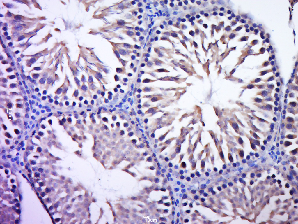 Paraformaldehyde-fixed, paraffin embedded rat testis; Antigen retrieval by boiling in sodium citrate buffer (pH6.0) for 15min; Block endogenous peroxidase by 3% hydrogen peroxide for 20 minutes; Blocking buffer (normal goat serum) at 37°C for 30min; Antibody incubation with C7orf57 Polyclonal Antibody, Unconjugated (bs-15274R) at 1:400 overnight at 4°C, followed by a conjugated secondary antibody for 20 minutes and DAB staining.